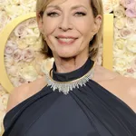 Allison Janney